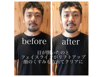 【男性の方必見】 夏でもさらさらお肌をゲット_20180725_3
